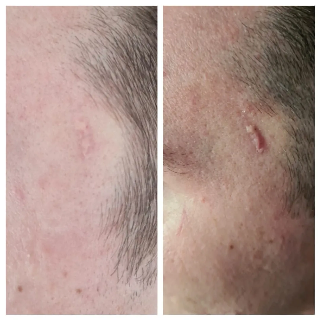 Various types of scars, illustrative photo