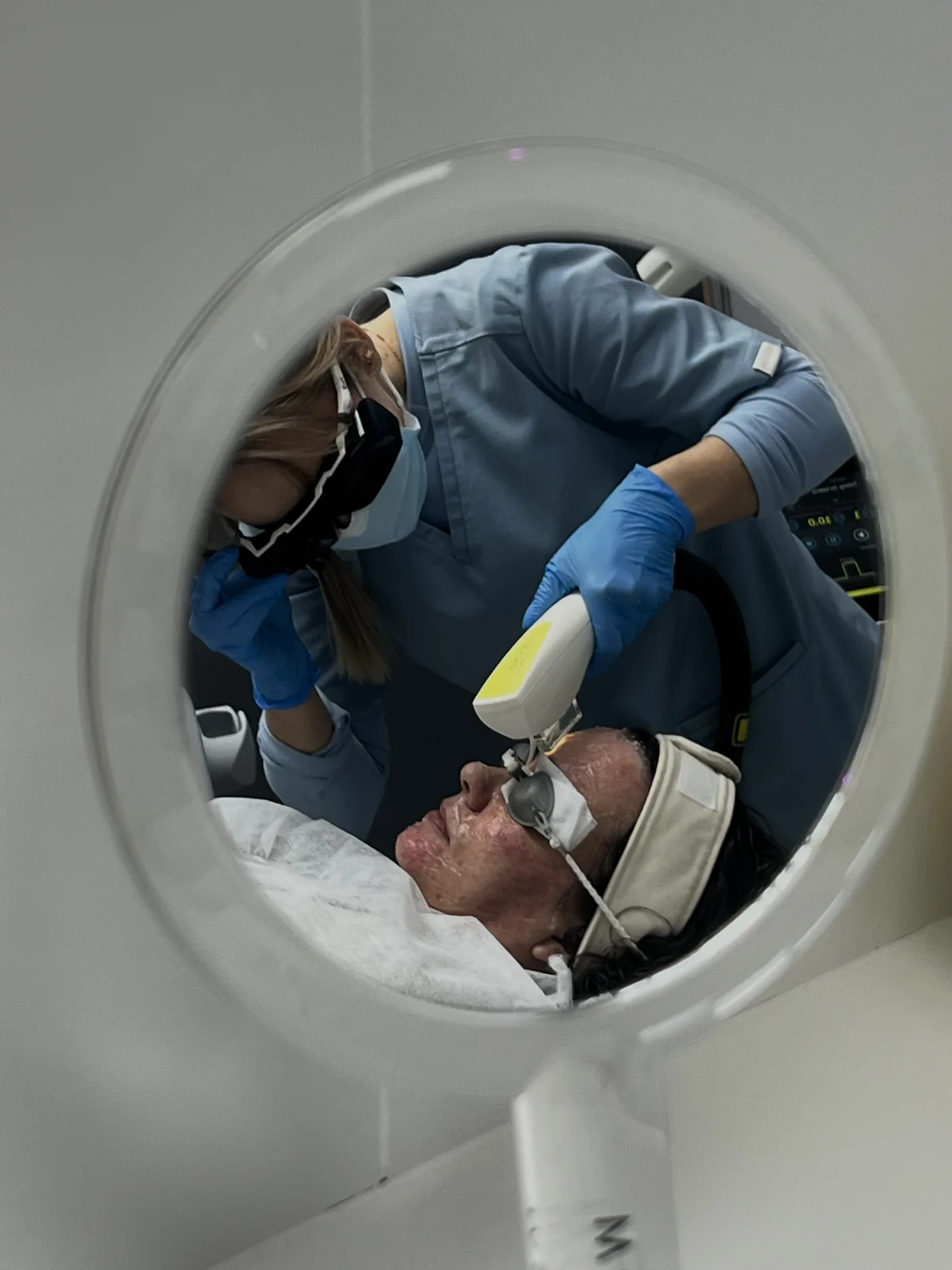 Vascular laser treatment at NL Clinic in Katowice