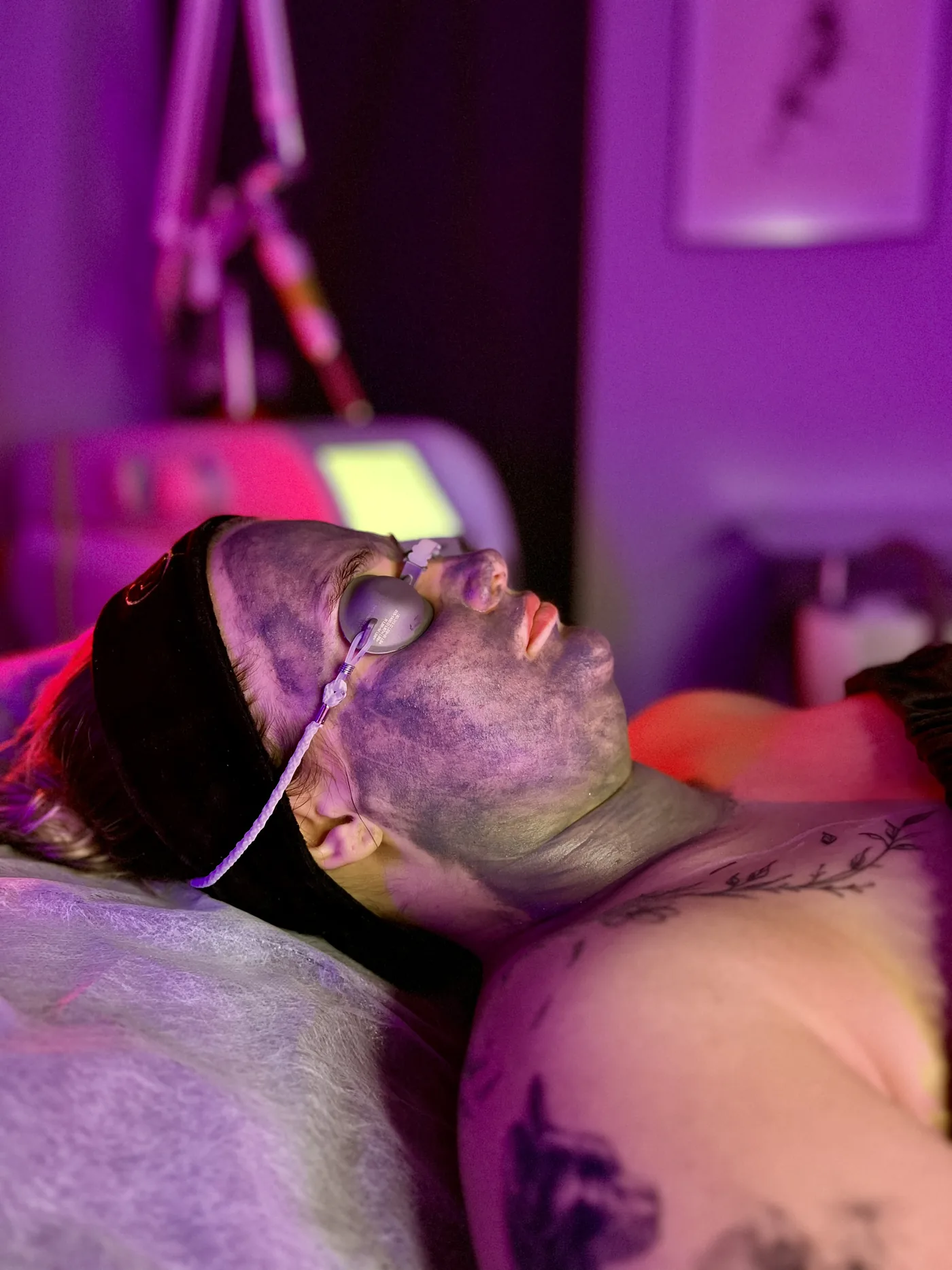 Carbon laser peel, a treatment at NL Clinic in Katowice