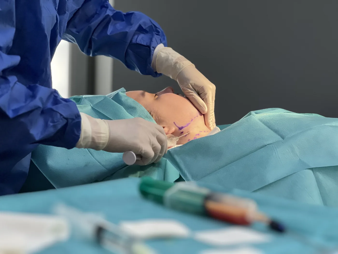 A chin liposuction treatment at NL Clinic in Katowice