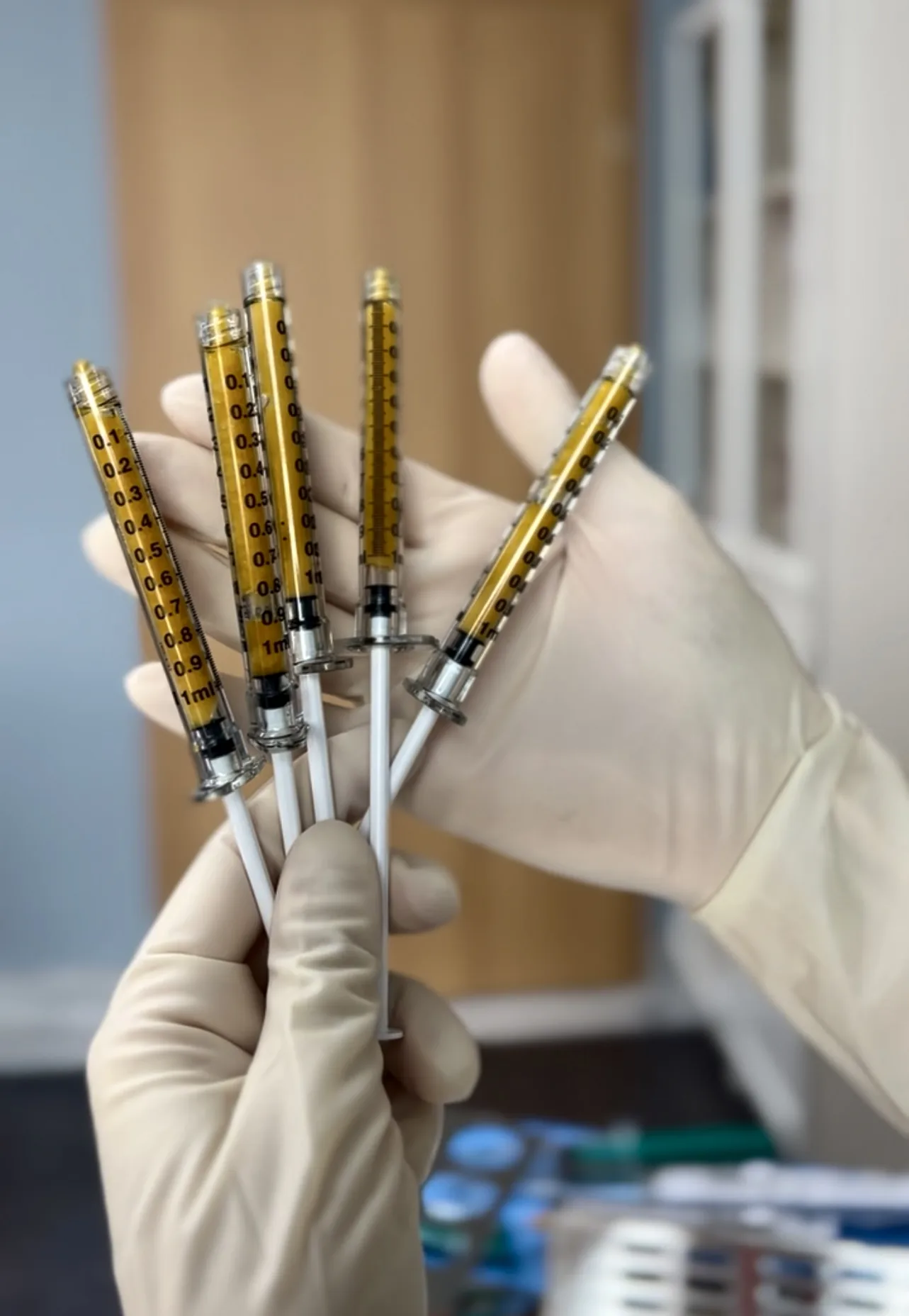 Preparation of the fat graft for hand lipotransfer at NL Clinic