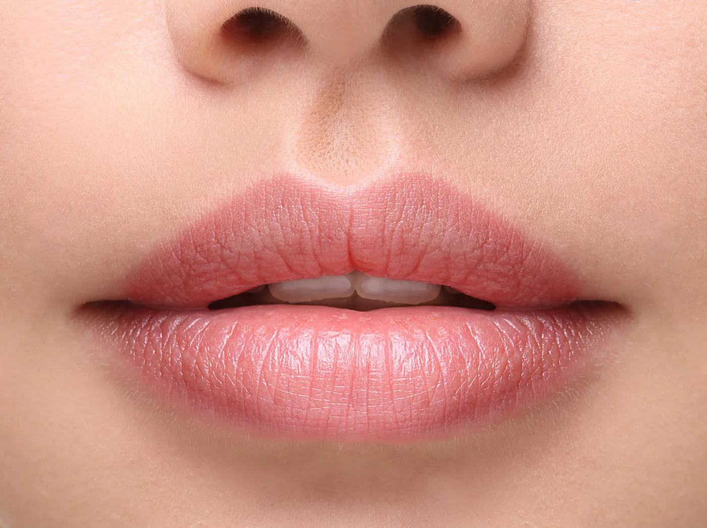 Lip area, illustrative photo
