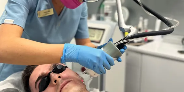 CO2 fractional laser treatment