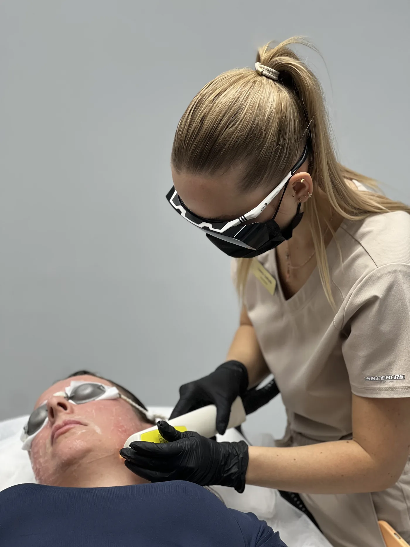 Zabieg IPL przy zmianach naczyniowych w NL Clinic