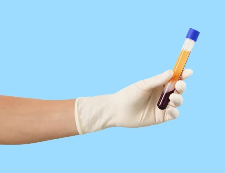 Platelet-rich plasma treatment at NL Clinic in Katowice