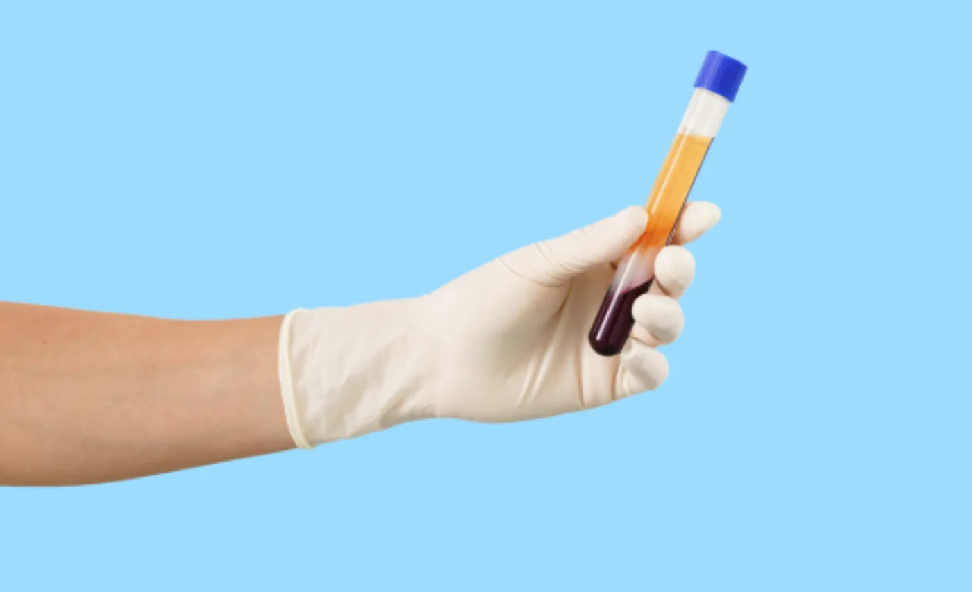 Test tube with blood after centrifugation: plasma above the blood cells