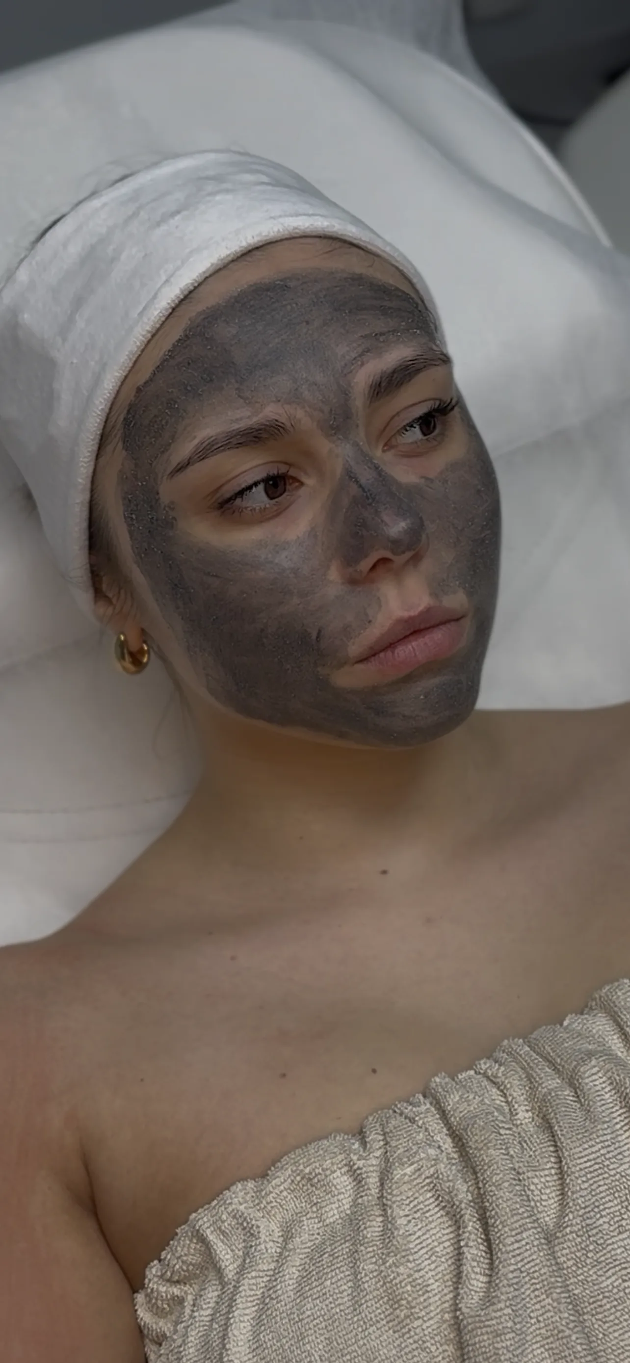 Laserowy peeling węglowy w NL Clinic w Katowicach