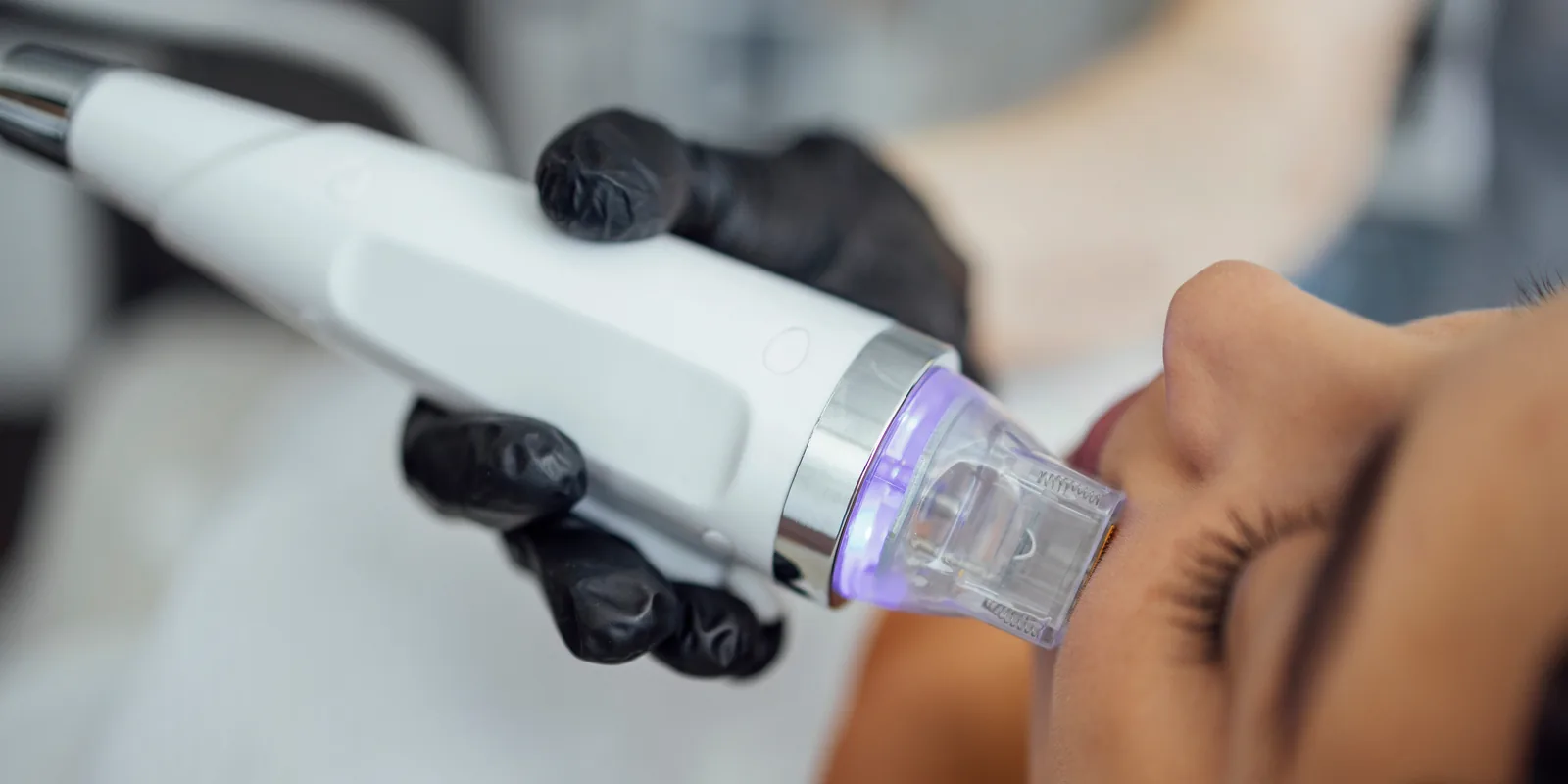 Radiofrequency treatment at NL Clinic in Katowice