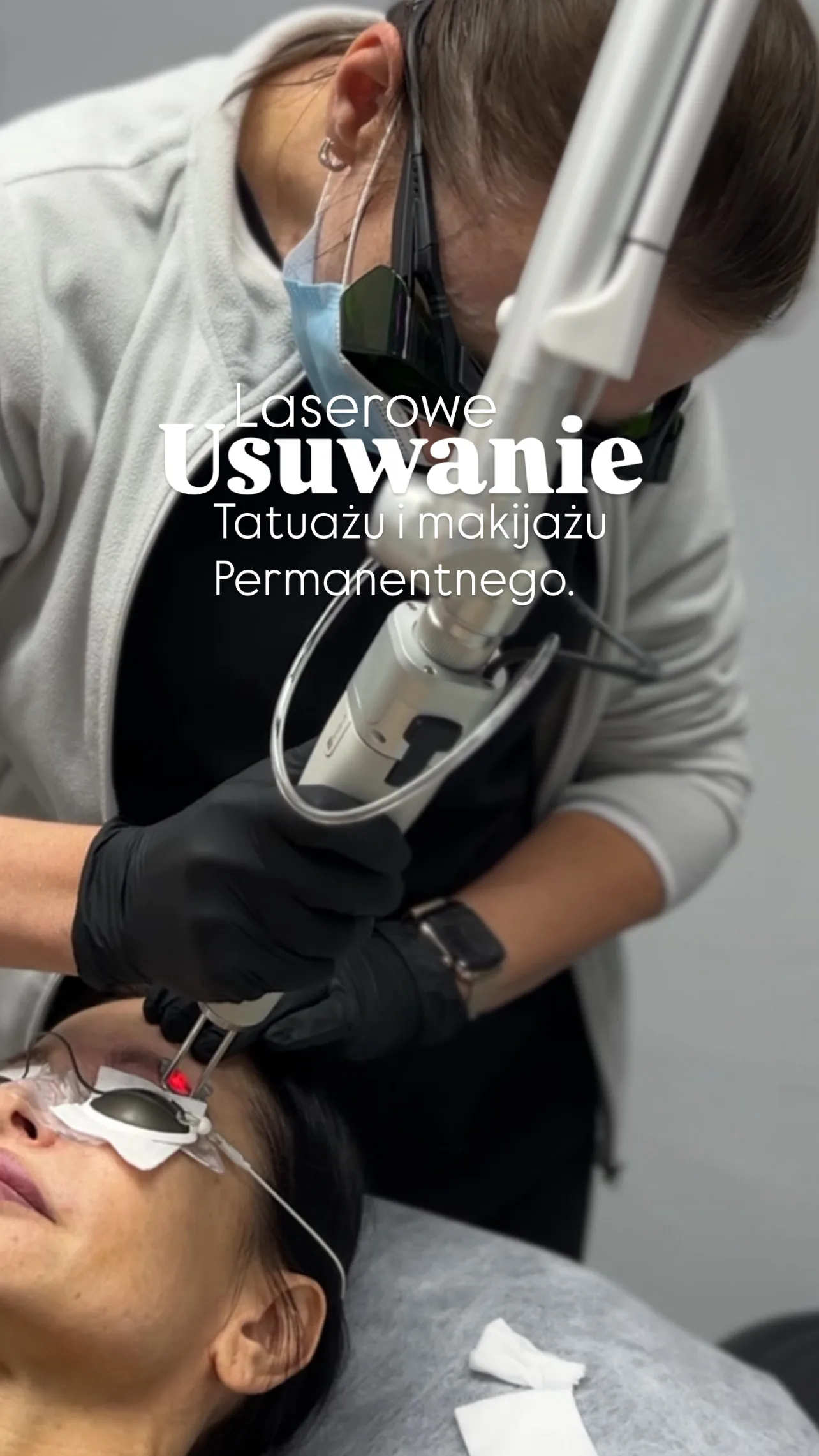 Laser tattoo removal at NL Clinic in Katowice
