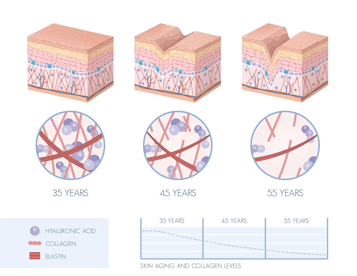 Diagram of skin changes associated with ageing